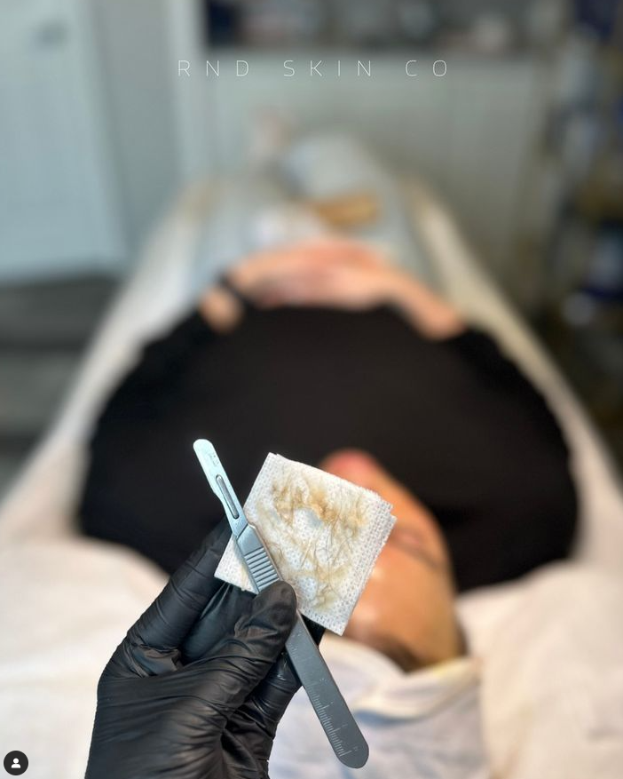 Dermaplaning from RnD Skin Co.