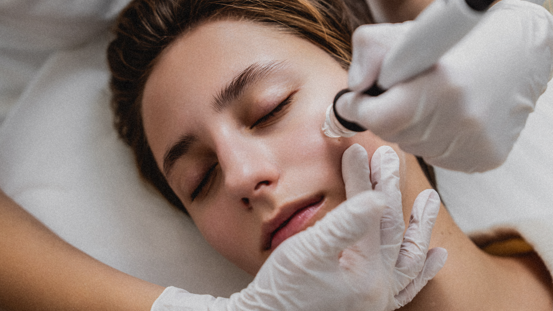 Microneedling at RnD Skin Co